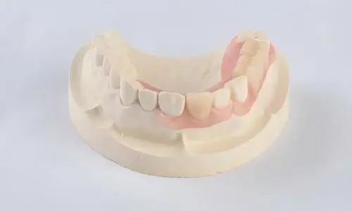 How Can Dental Labs Source Valplast Dentures for Flexible Cases?